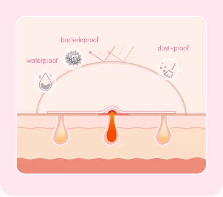 Features-of-hydrocolloid-wound-plaster.jpg